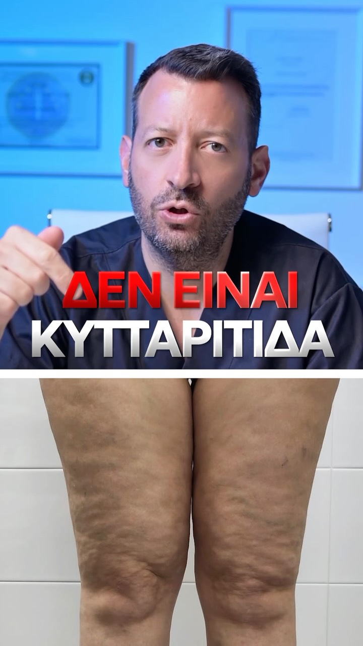 Ο Δρ. Νίκος Παπαχρήστος εξηγεί τι είναι το λιποίδημα